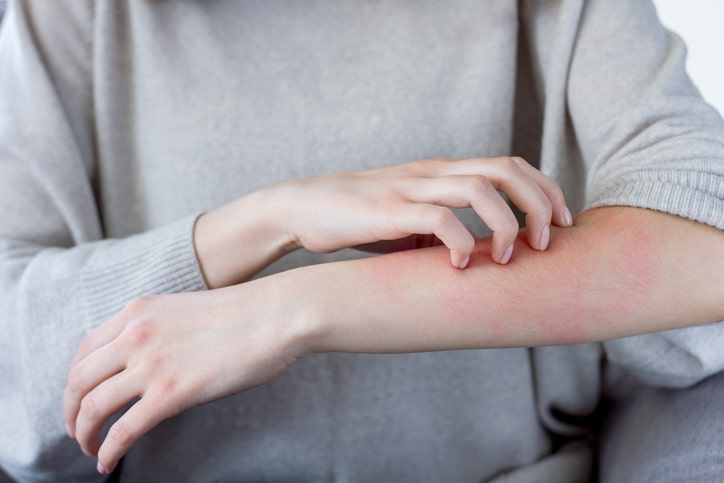 skin reaction on arm from clothing