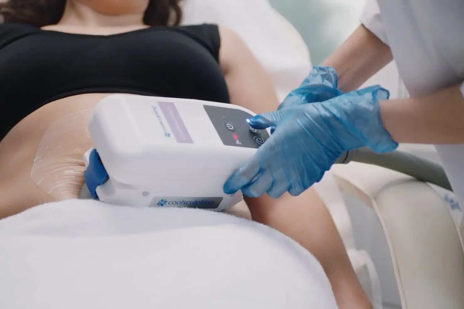 CoolSculpting procedure