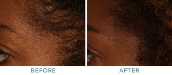 Hair 1