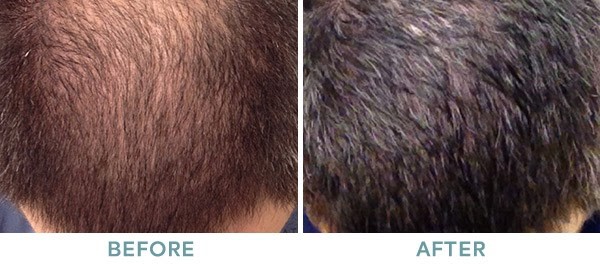 Hair 5