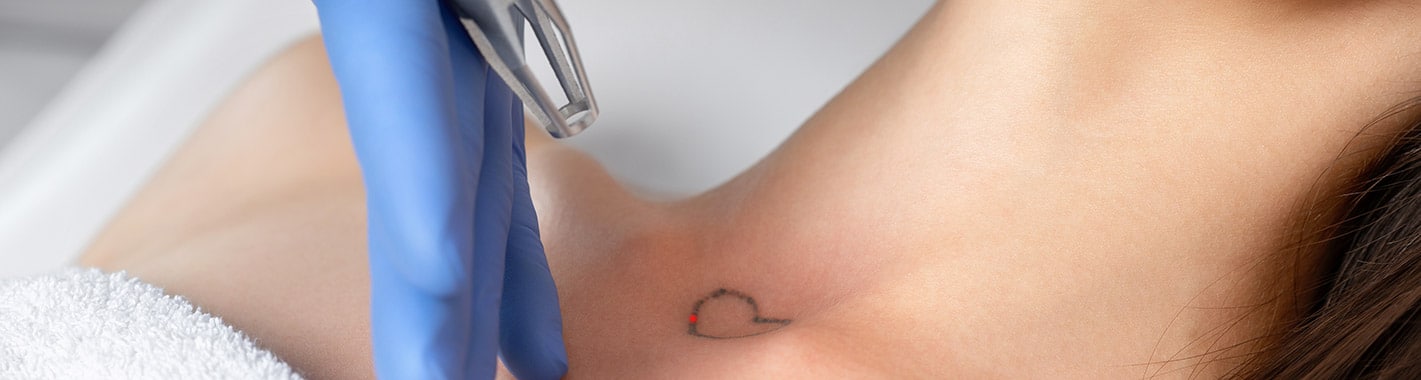 Take It Off Laser Tattoo Removal Louisville Ky Lake Point Cir Louisville  KY Tattoos  Piercing  MapQuest