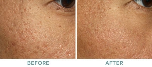 skin 12