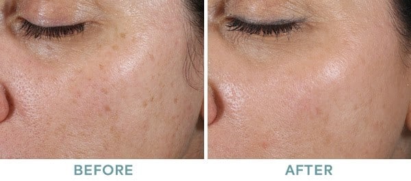 skin 5