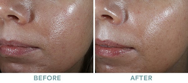 skin 6