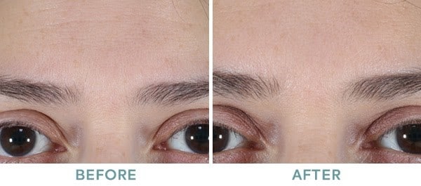 wrinkle 3