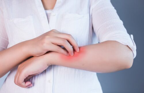 allergic skin reaction on forearm