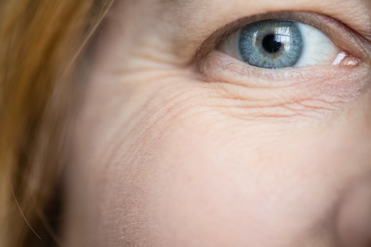 close up of woman with eye wrinkles