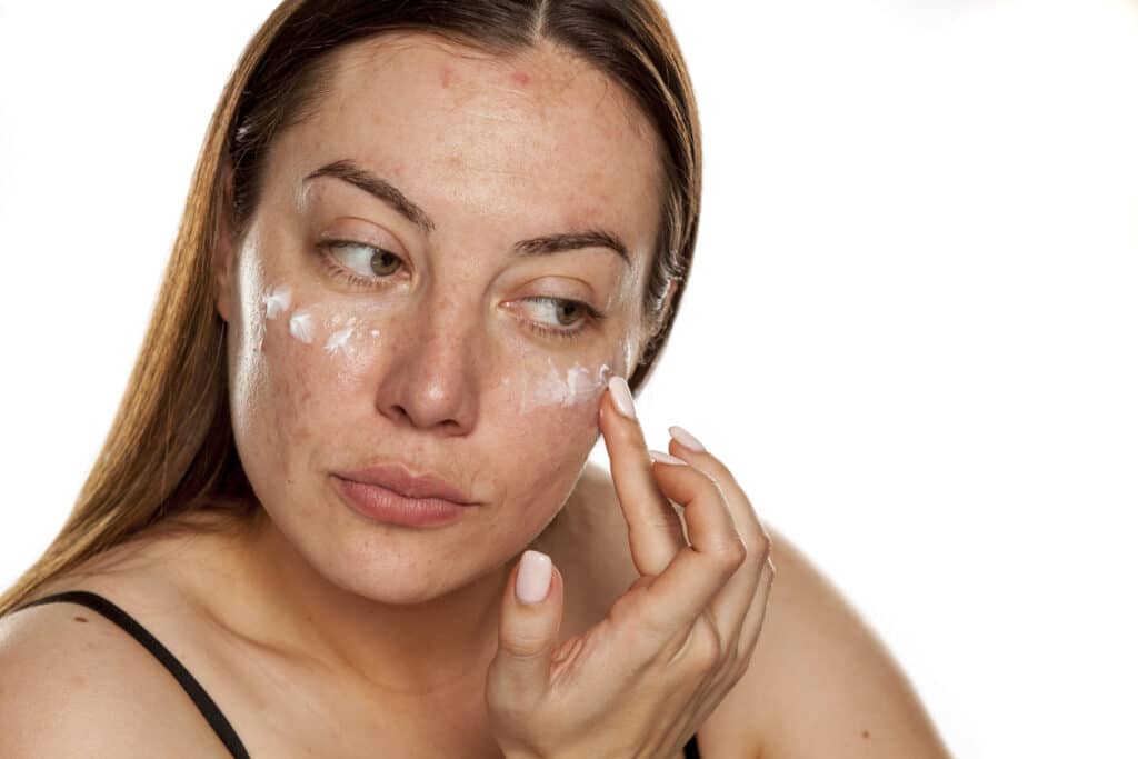 woman applying moisturizer on her face