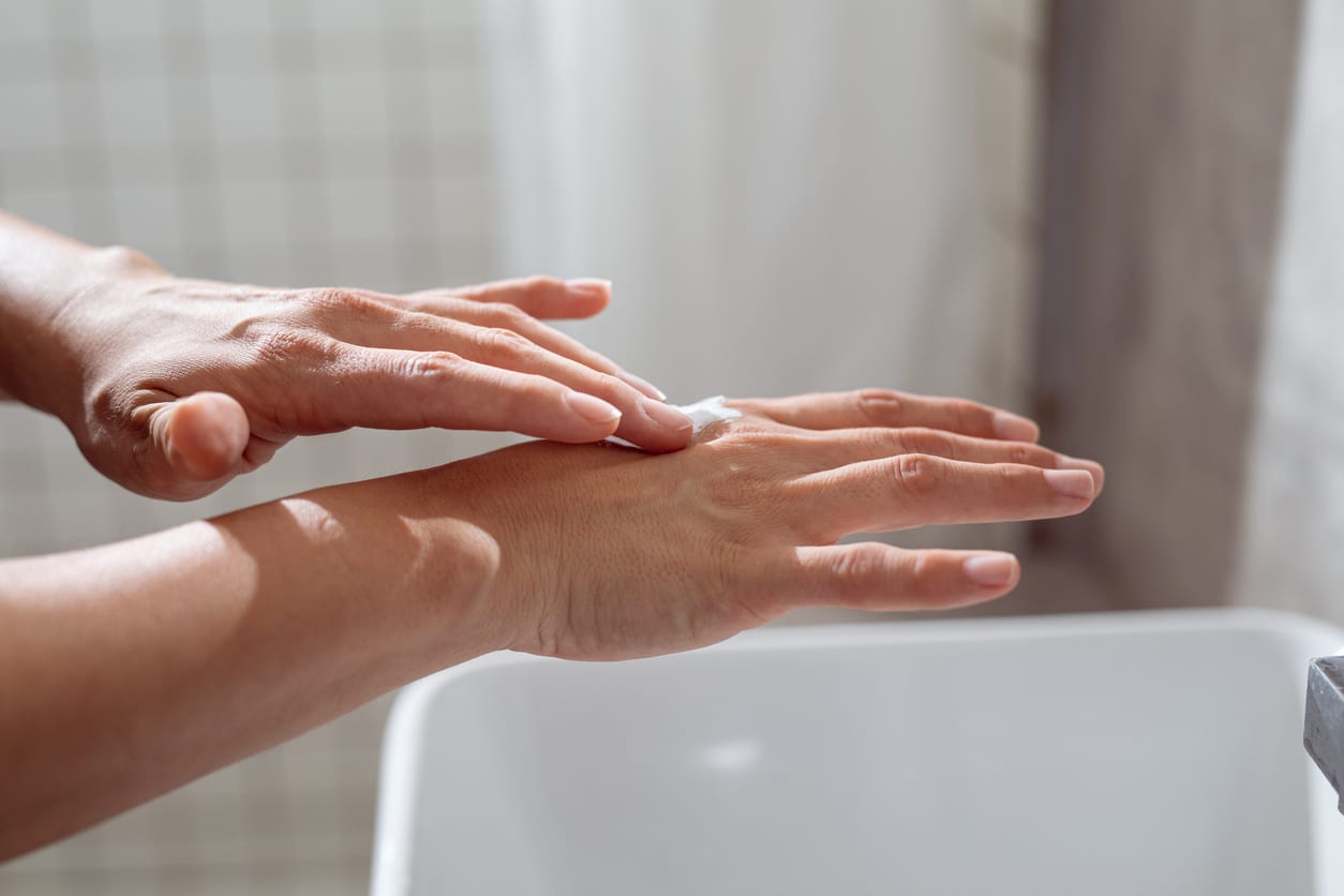 A young woman applying a lotion to the dry skin on her hands.