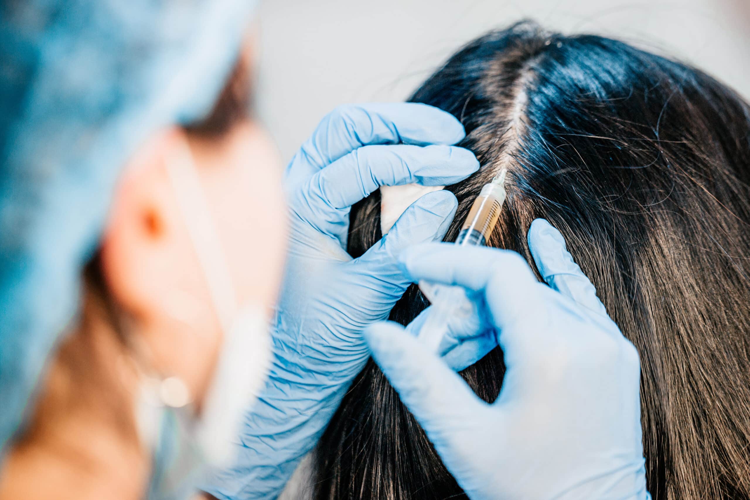 Cosmetology plasma injection into the scalp