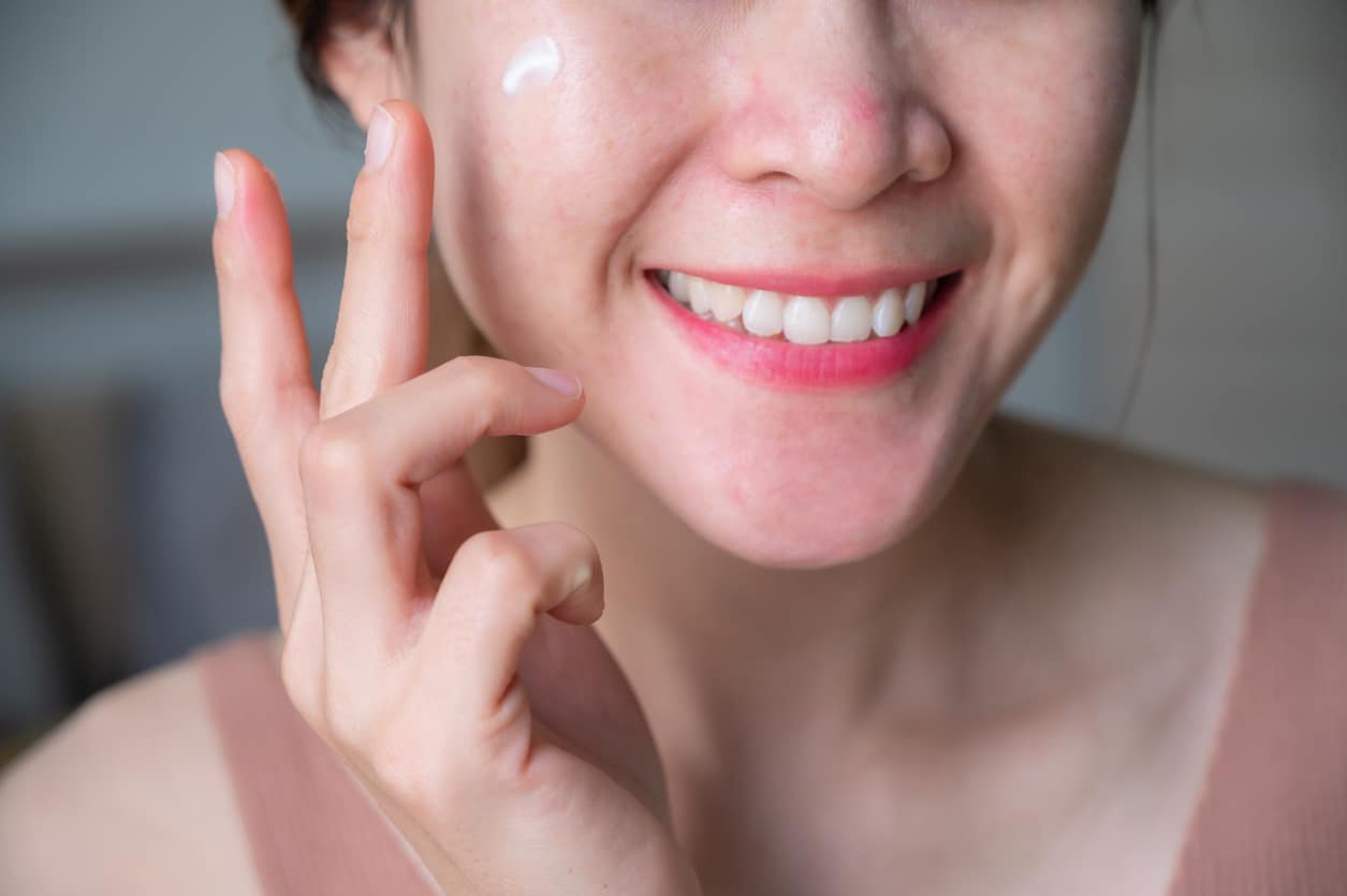 Cropped shot of Asian woman applying cream on her face for treating redness skin.