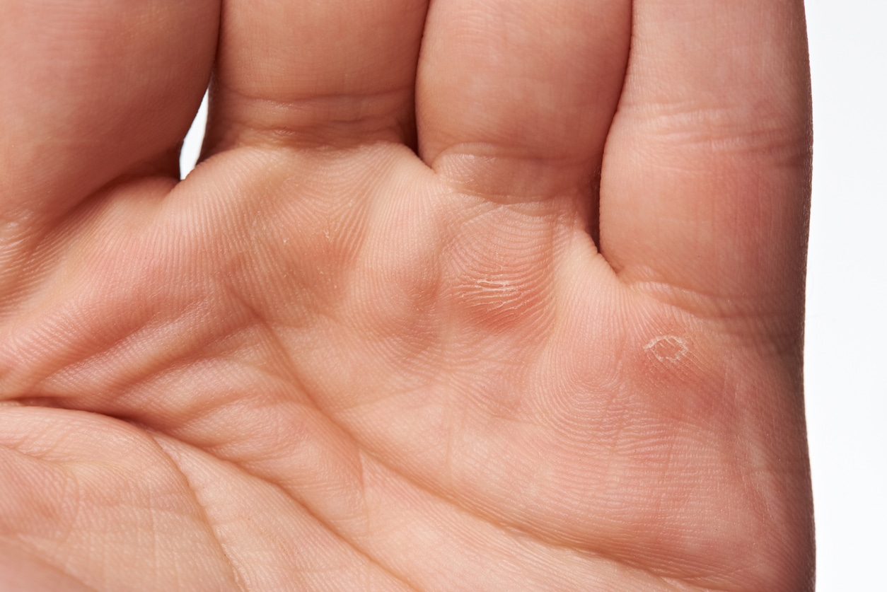 Close up shot of a hand with calluses below the fingers.