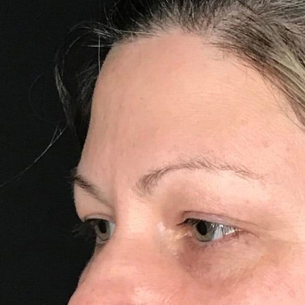 pinski microblading 2 before