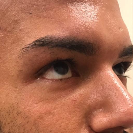 pinski microblading 5 before