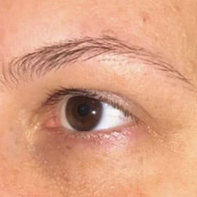 pinski microblading 7 before