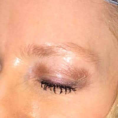 pinski microblading 8 before